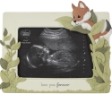 Precious Moments 203115 Sonogram Newborn Photo Frame